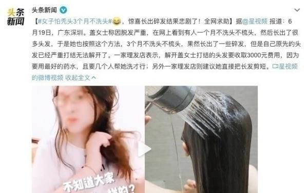 应对脱发不焦虑 治脱发的正确操作看这里