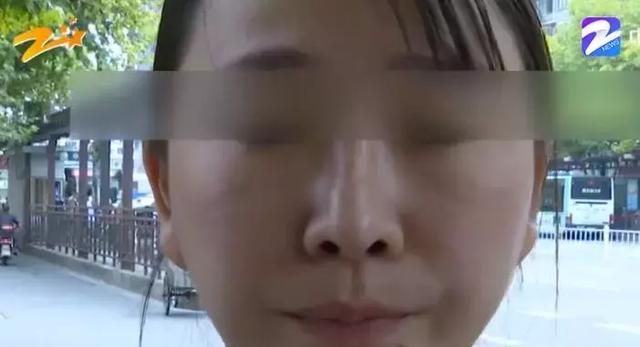 绍兴女子为隆鼻，花十万取自己肋骨，术后：鼻子歪、难呼吸！
