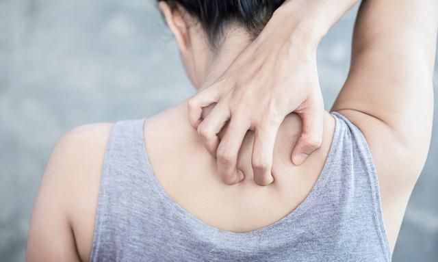 身上长了很多小红点，像痣一样，是得了肝病？排查一下这4个原因
