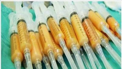 自体脂肪隆胸有什么优点？缺点是什么