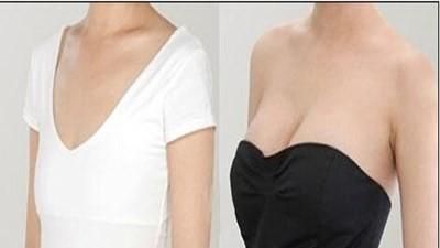 自体脂肪隆胸有什么优点？缺点是什么