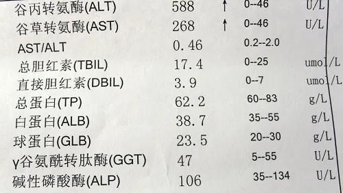 一文搞懂肝功能！