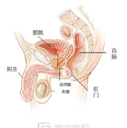 什么检查前列腺需要经直肠指检图1