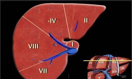 超详细的肝脏解剖图解，赶紧拿走！