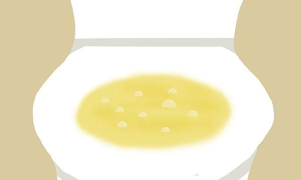 烧心天敌奥美拉唑，缓解胃痛真有那么管用吗？长期吃会怎么样？
