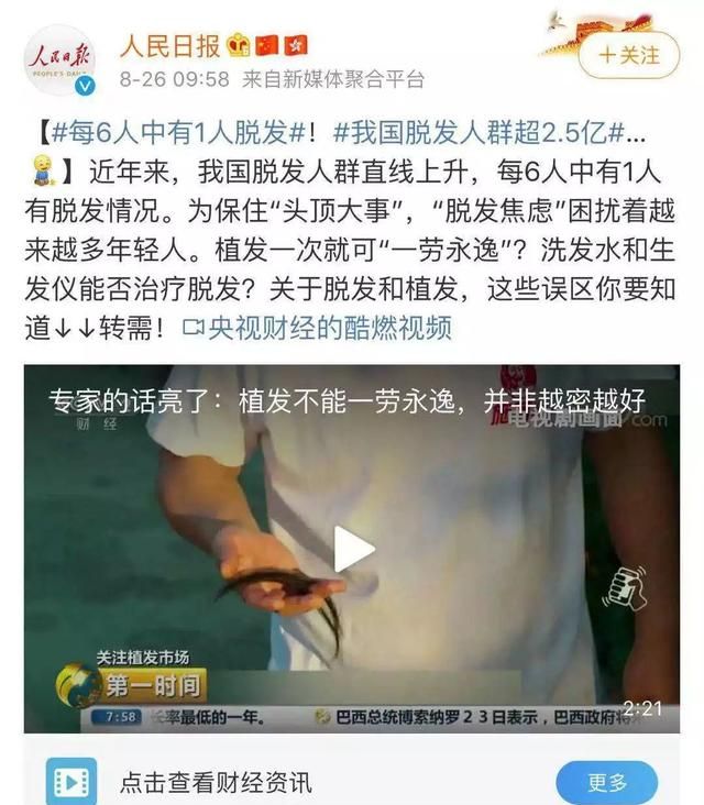 每天洗头会导致脱发？为何偏偏就是你要脱……医生告诉你真相