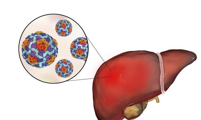 吃药竟然会患上肝炎？严重情况会危及生命！千万别当小事
