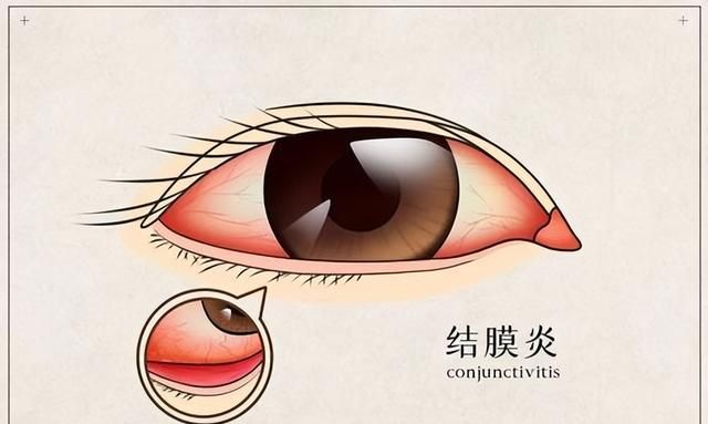 几块钱一盒的龙胆泻肝丸，不止能清肝泻火，还可治这5种常见疾病