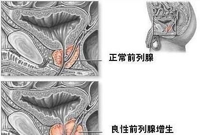 尿分叉到底是不是病，看这4点