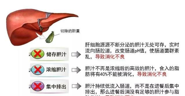 胆囊切除后饮食应该注意哪些？