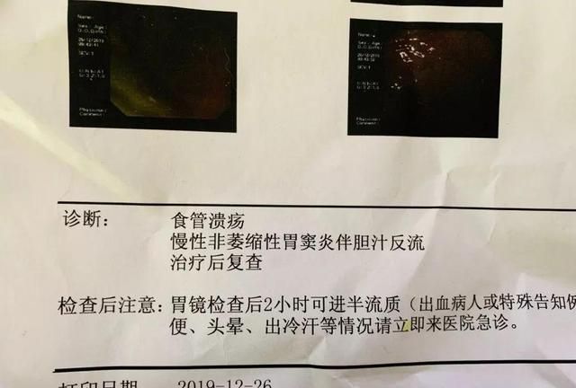 吃完火锅后，姑娘开始吐血！原因令人意想不到