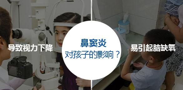 鼻窦炎的危害，还要轻视到什么时候？