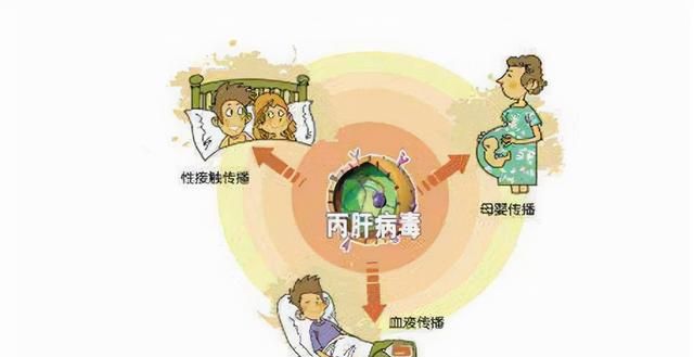 丙肝传播途径及预防