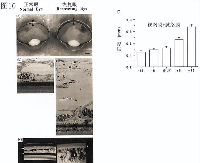 「万字纯干货」脉络膜的多种功能与近视调控