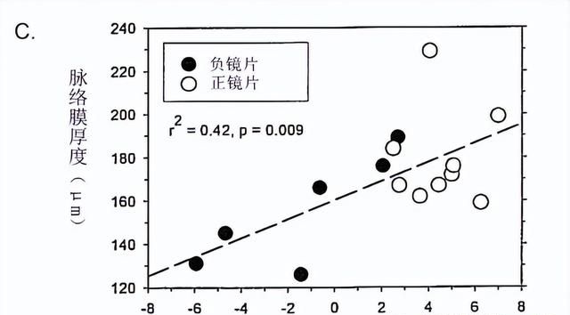 「万字纯干货」脉络膜的多种功能与近视调控