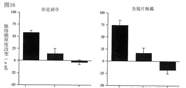 「万字纯干货」脉络膜的多种功能与近视调控