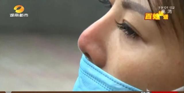 反复发炎还冒出线头！长沙女子花2.3万元隆鼻后，鼻头下降