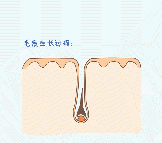 女性雄激素性脱发（脂溢性脱发）的常用治疗药物有哪些？