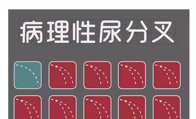 男性朋友，小便分叉是怎么回事？临床医生一文给大家说清楚