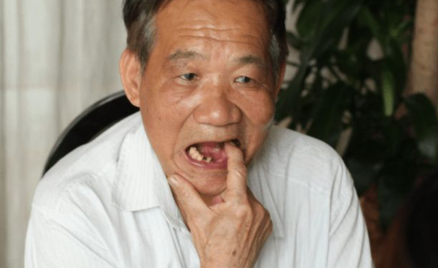 转氨酶是肝脏健康的“晴雨表”！身上发出6种信号，请查肝功