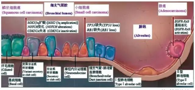 肺腺癌新旧分类对照、纵隔淋巴结分区、肺癌TNM分期