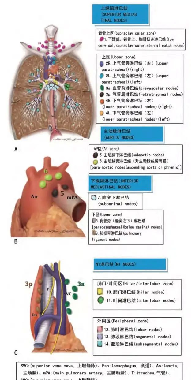 肺腺癌新旧分类对照、纵隔淋巴结分区、肺癌TNM分期