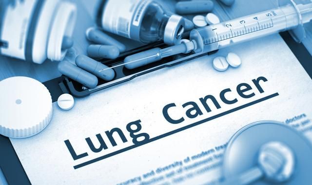 肺癌到了晚期能活多久，不治疗会活得更长吗？有三个决定因素