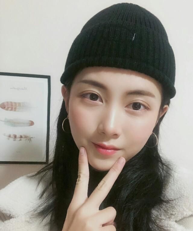 3.5万做了隆鼻，好看的鼻子真香！