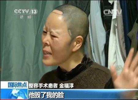 韩国人6元祛痣6600元割双眼皮！向中国人收费竟比原价多87倍！
