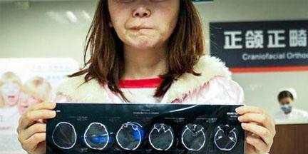 韩国人6元祛痣6600元割双眼皮！向中国人收费竟比原价多87倍！