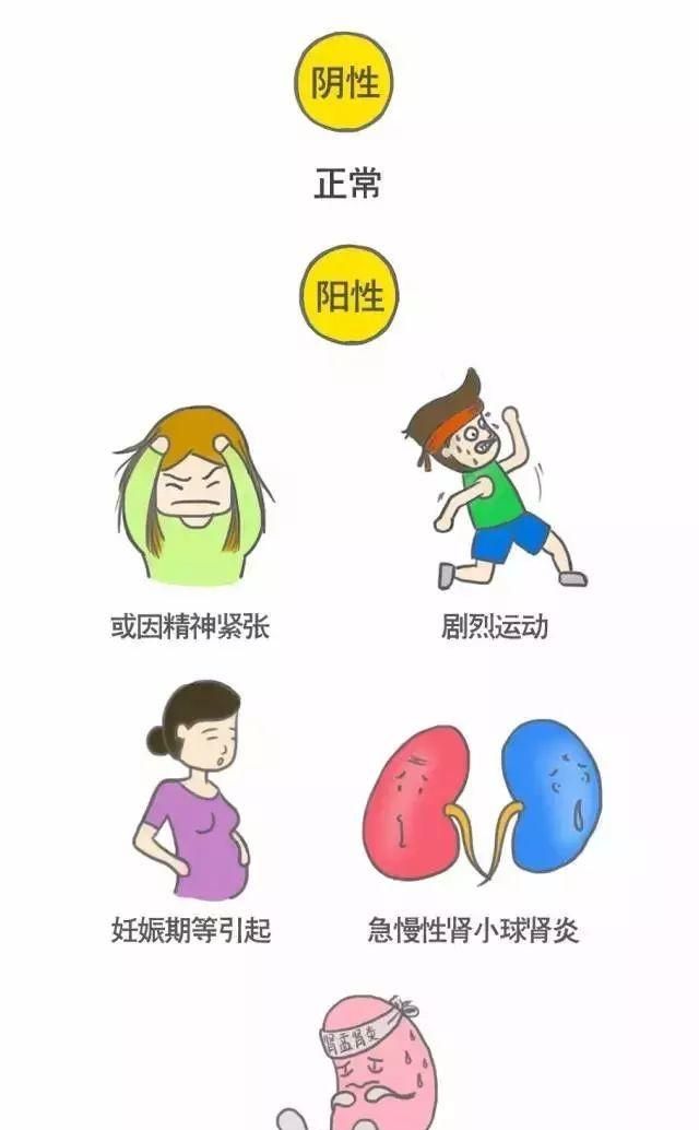 如何治疗蛋白尿不复发图2