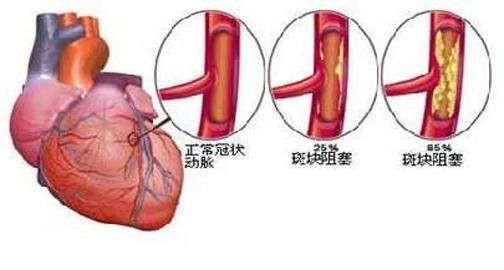 三七粉几乎无副作用，却“能”活血、止血、补血、保护心肌、抗心律失常、降血脂、降血压·····这合理吗图7