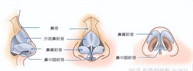 歪鼻有哪几种类型，又该如何修复？