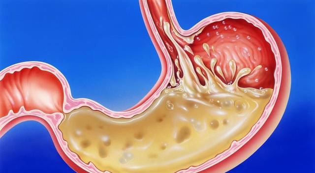 经常打嗝胃胀气，代表你要养胃了，3个方法养出一个好胃