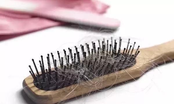 女性脱发的原因和治疗方法 及时治疗还你浓密秀发