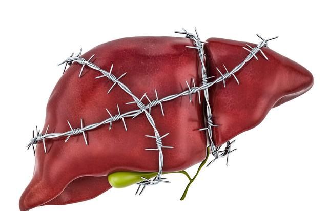 肝病一旦恶化，身体会吹响4个“号角声”！有人已经留意到了