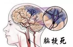 阿司匹林吃多长时间可以停用(阿司匹林服用多长时间可以停)图6