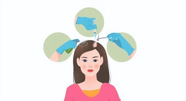 女性脱发该如何挽回“三千烦恼丝”？