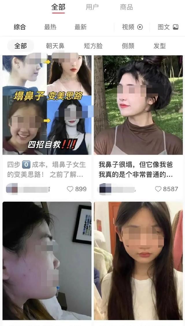 花什么几十万做鼻子？想要隆鼻好看，看完这一篇就够了！
