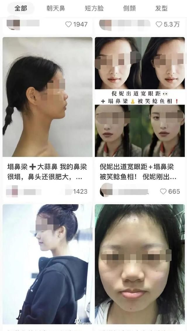花什么几十万做鼻子？想要隆鼻好看，看完这一篇就够了！