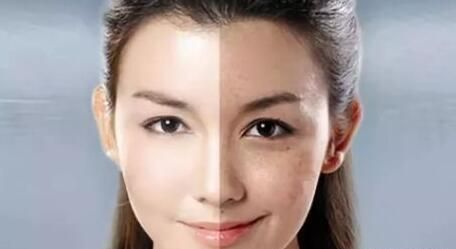 白真的能遮百丑吗图1