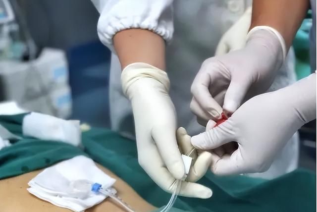 治疗不及时可能危及生命，急性胆囊炎有哪些治疗方法？