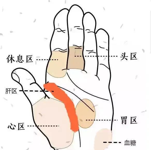 小鱼际发红有疙瘩怎么调理,小鱼际发红什么原因图1