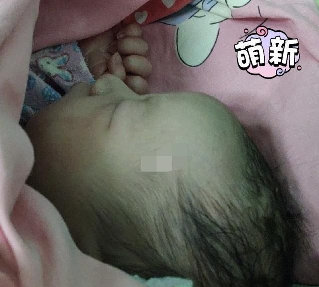 月子里不能吃哪些水果,剖腹产产妇月子不能吃什么水果图3