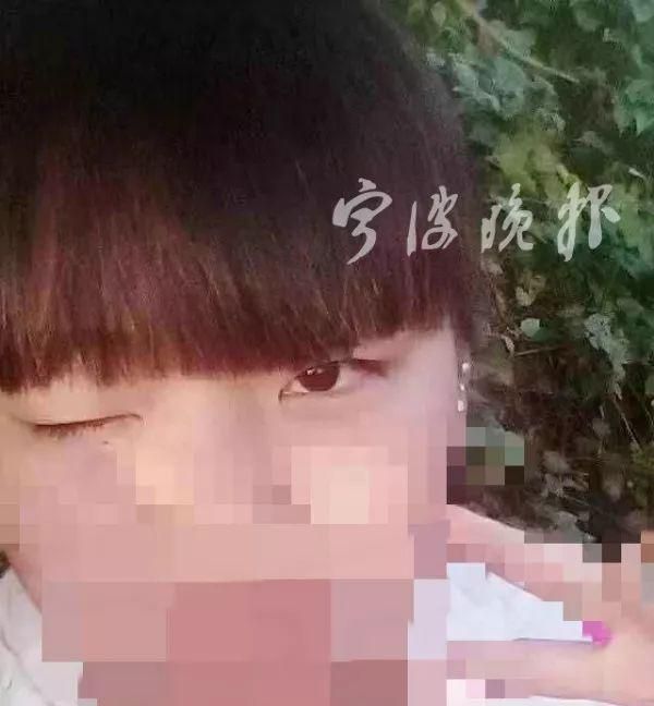 20岁女孩割完双眼皮眼睛闭不上了！这家整形医院竟说：这是最好效果了