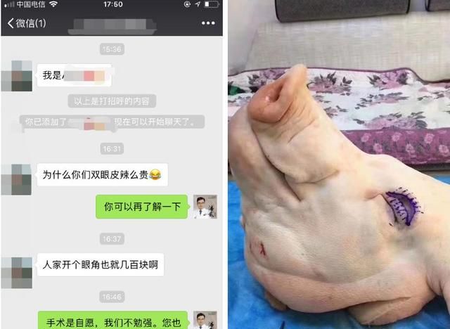 整形美容：不想被练手，割双眼皮花多少钱比较合适？