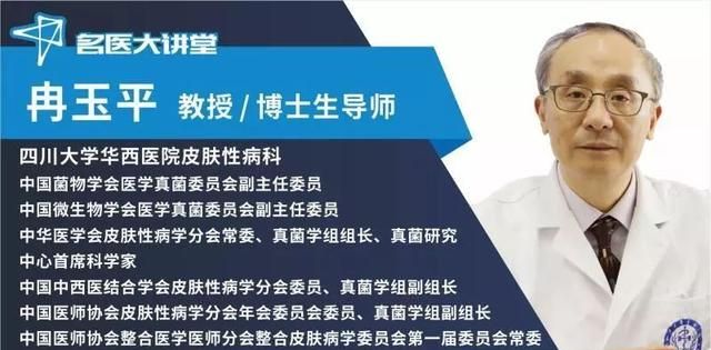 这种脱发，90%都能治好！华西冉玉平教授：秃不秃，决定权在你手里