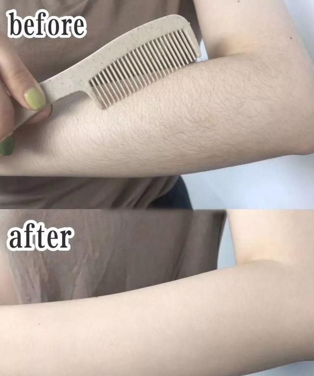 脱毛方法千千万，这个100块不到，让我彻底摆脱尴尬