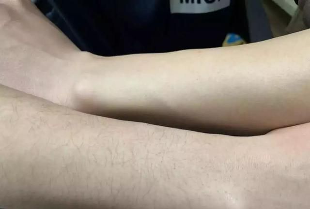 脱毛方法千千万，这个100块不到，让我彻底摆脱尴尬