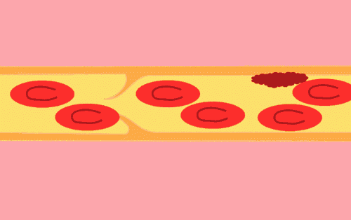 日本日研纳豆激酶胶囊~呵护心脑血管！